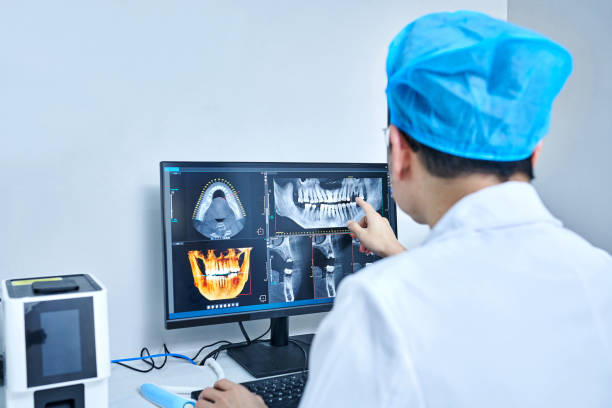 Best Emergency Wisdom Tooth Extraction in Smithville Sanders, IN
